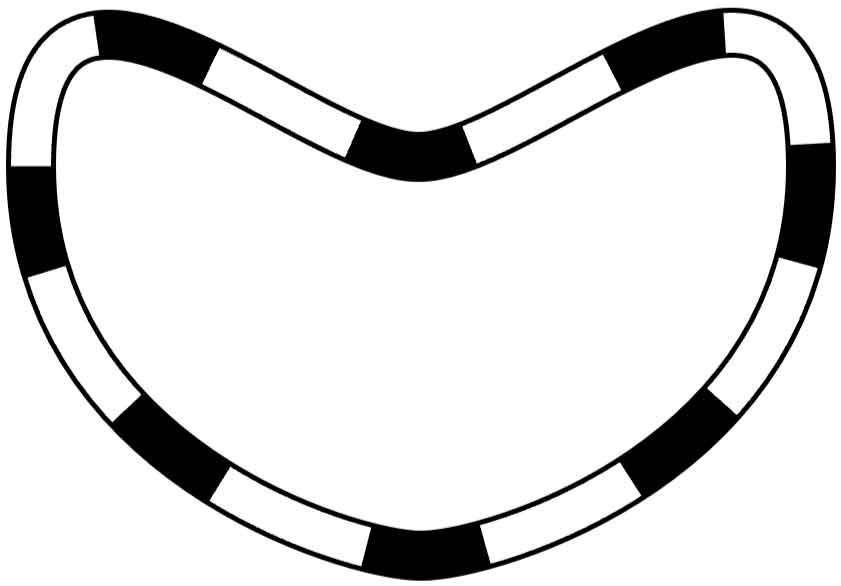 ハート型線路の太さを変えた図